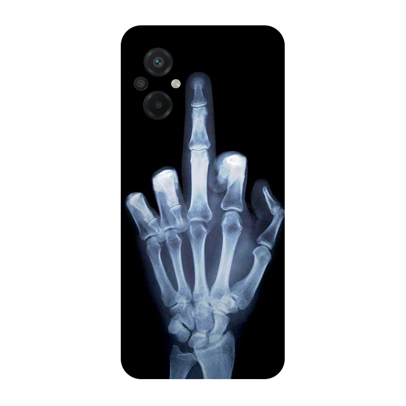 para Poco M5 2022 4G Funda Fút - Phone Cases Liverpool reseña y precio